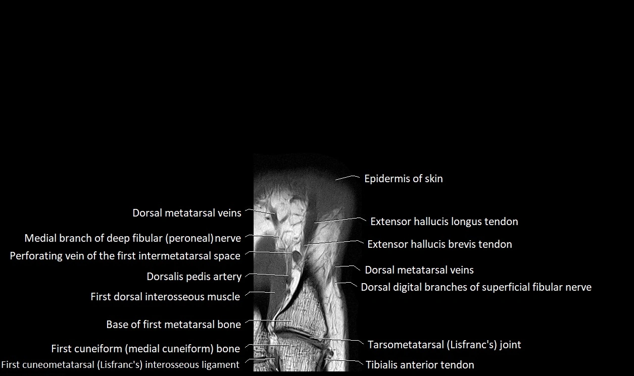 Great Toe micro anatomy MRI axial cross sectional 3T image 8.webp